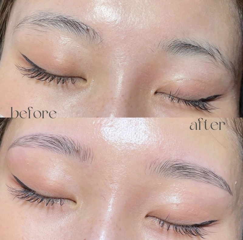 ハリウッドブロウリフト